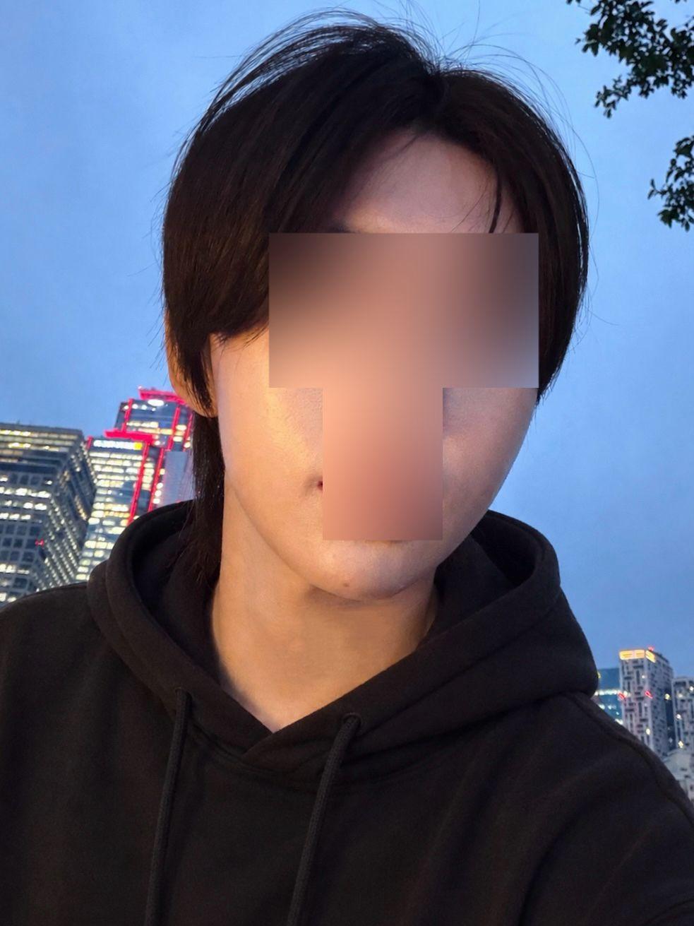 後
