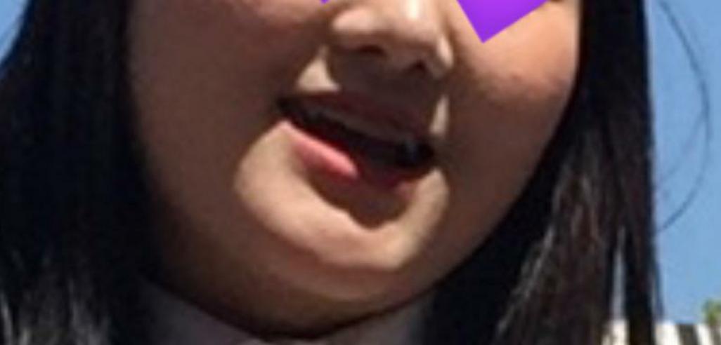 後