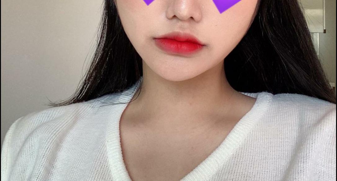 後