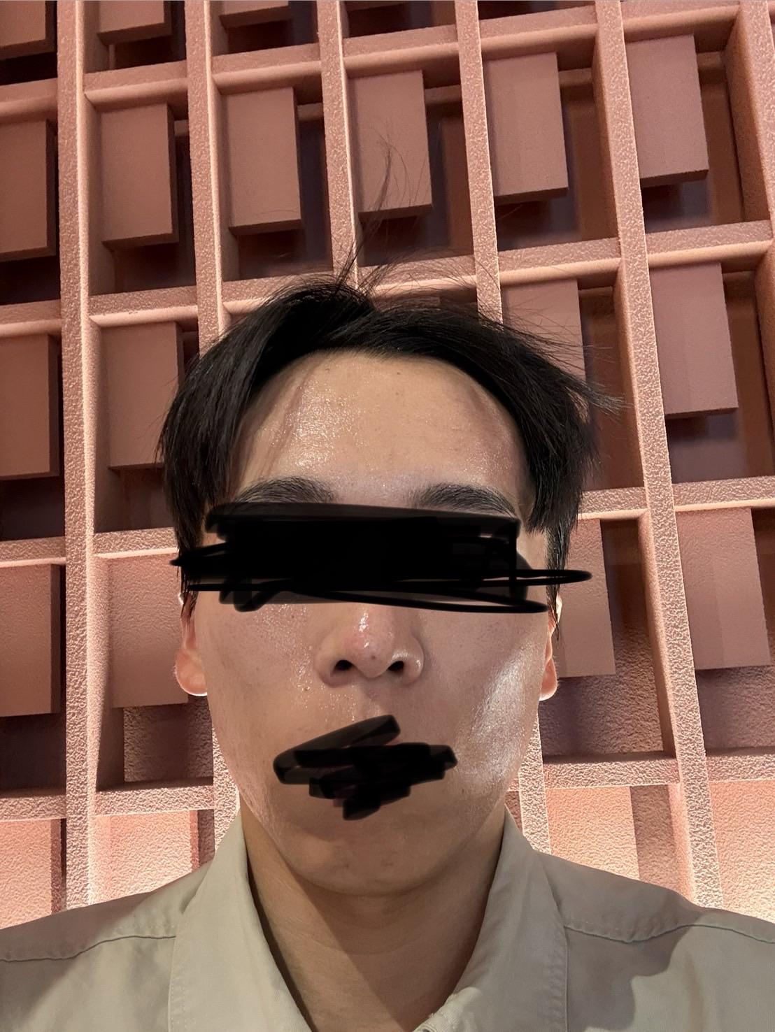 後