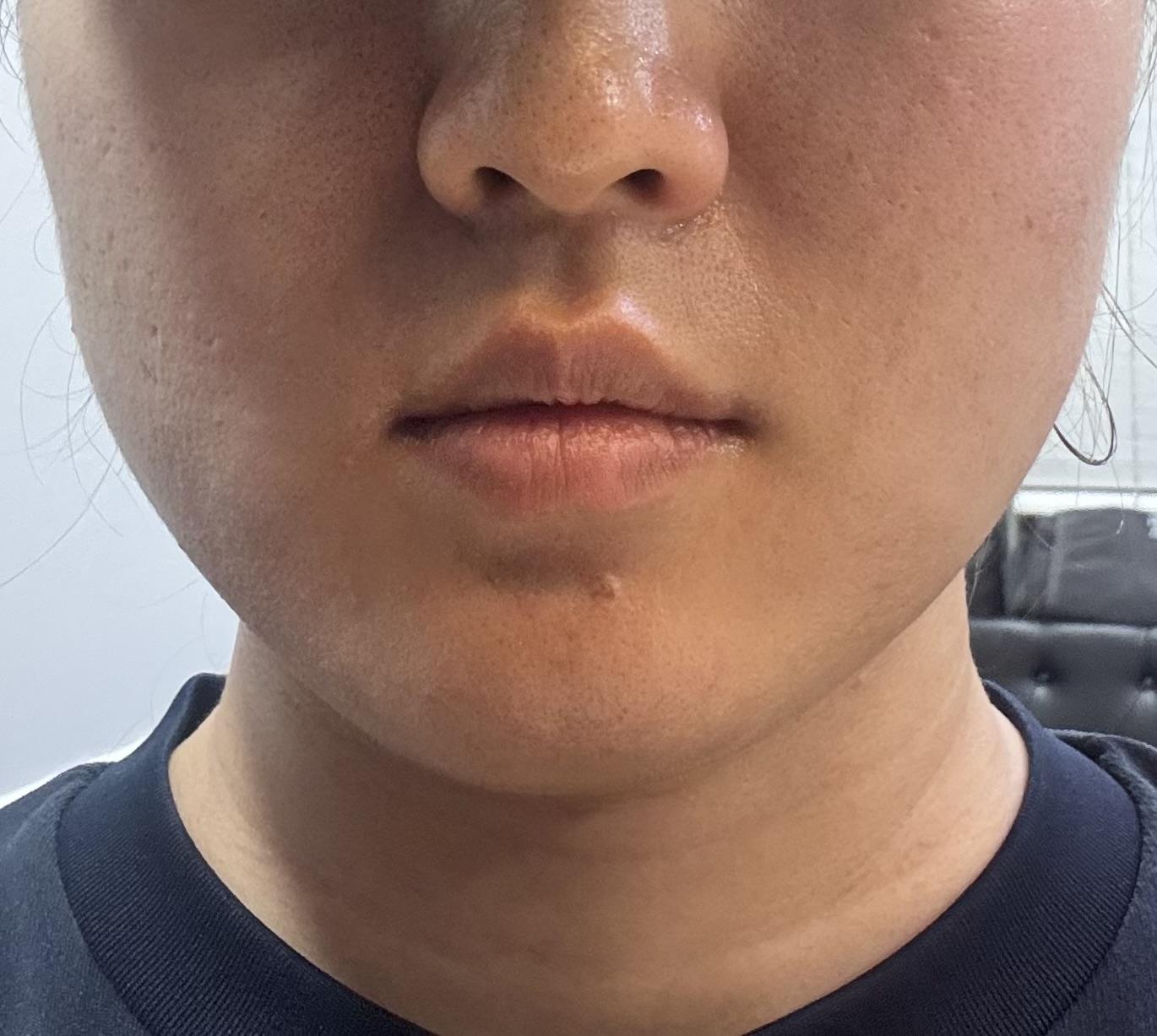 後