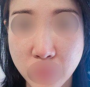 後