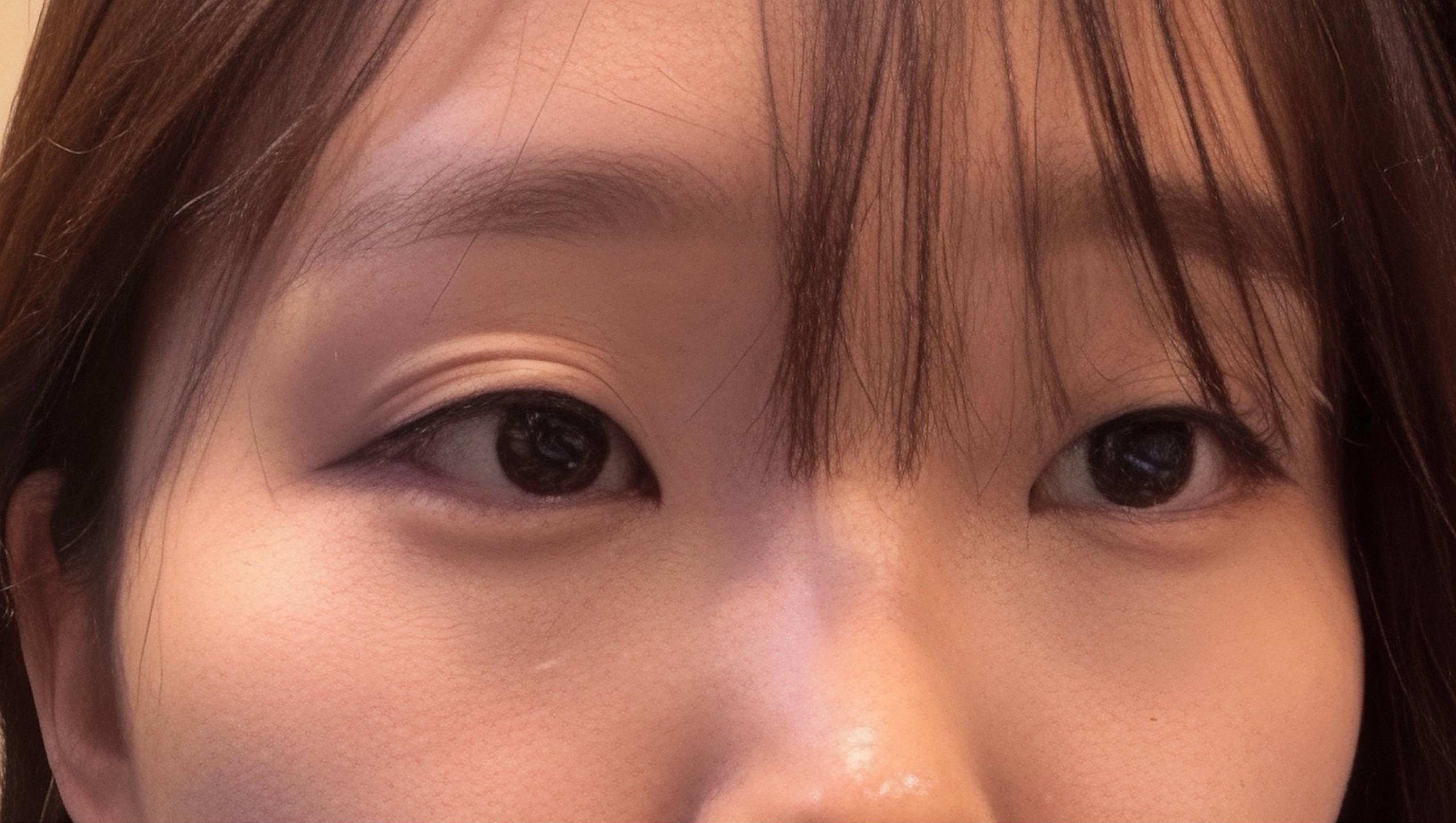 後