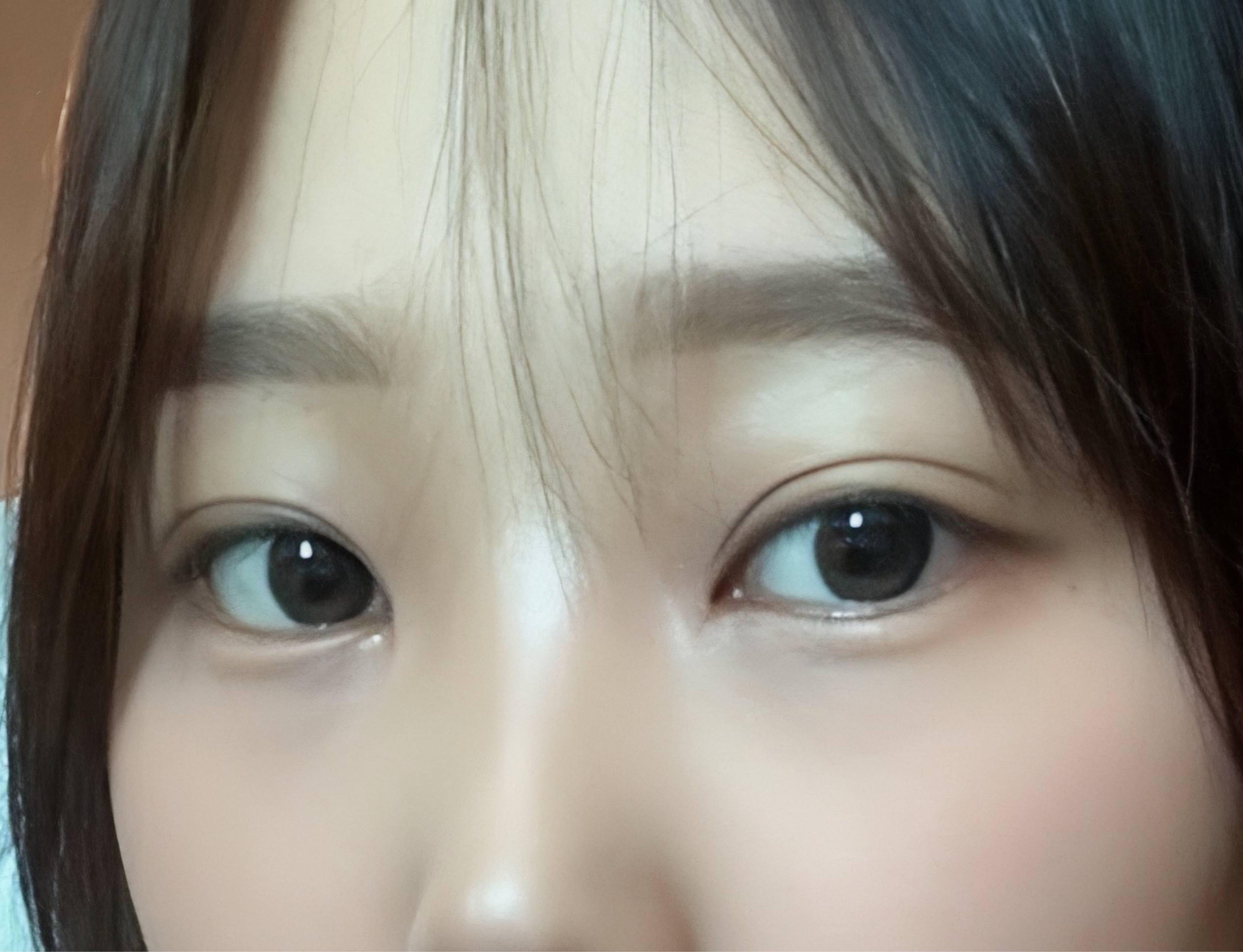 後