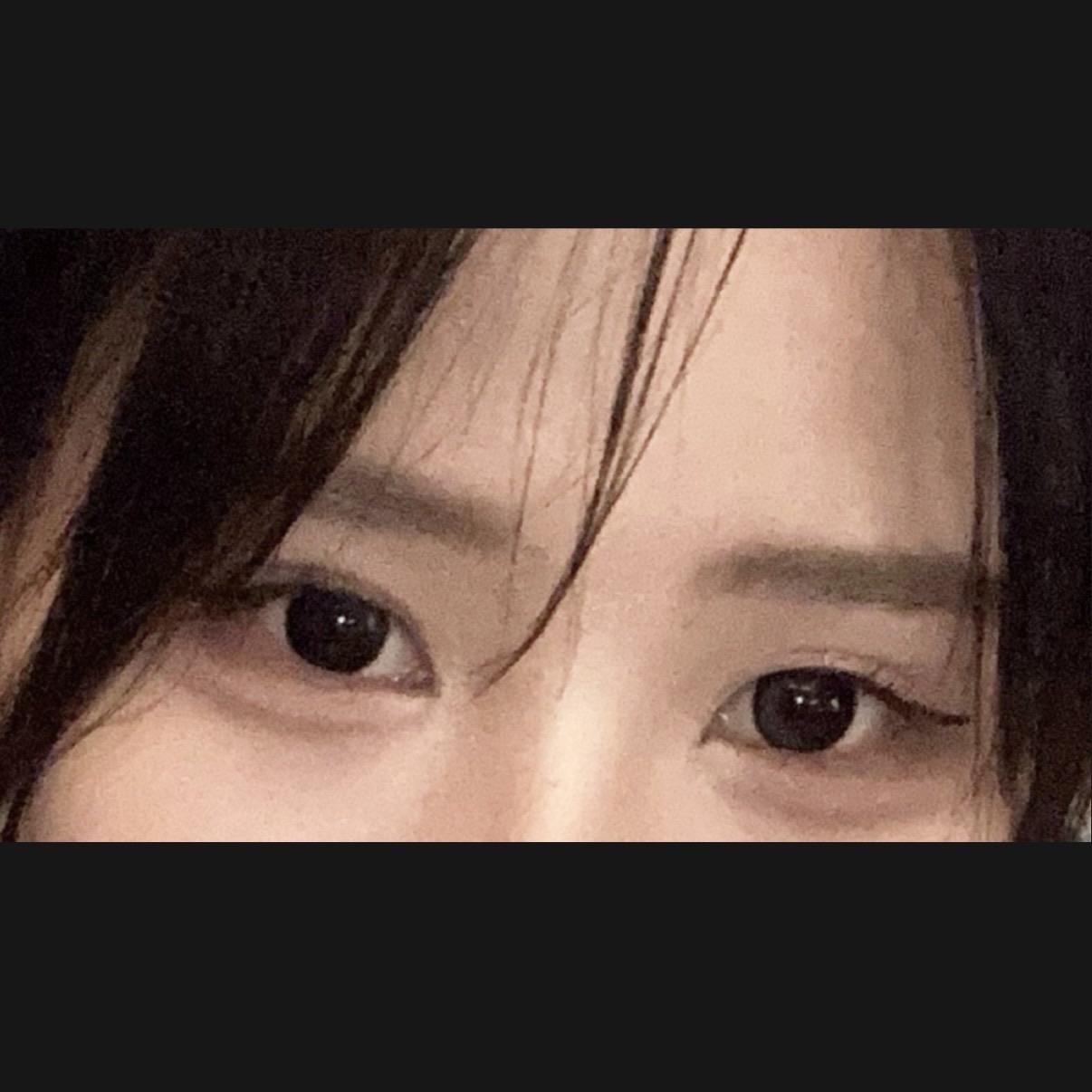 後