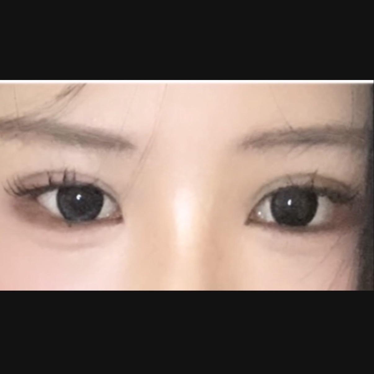 後