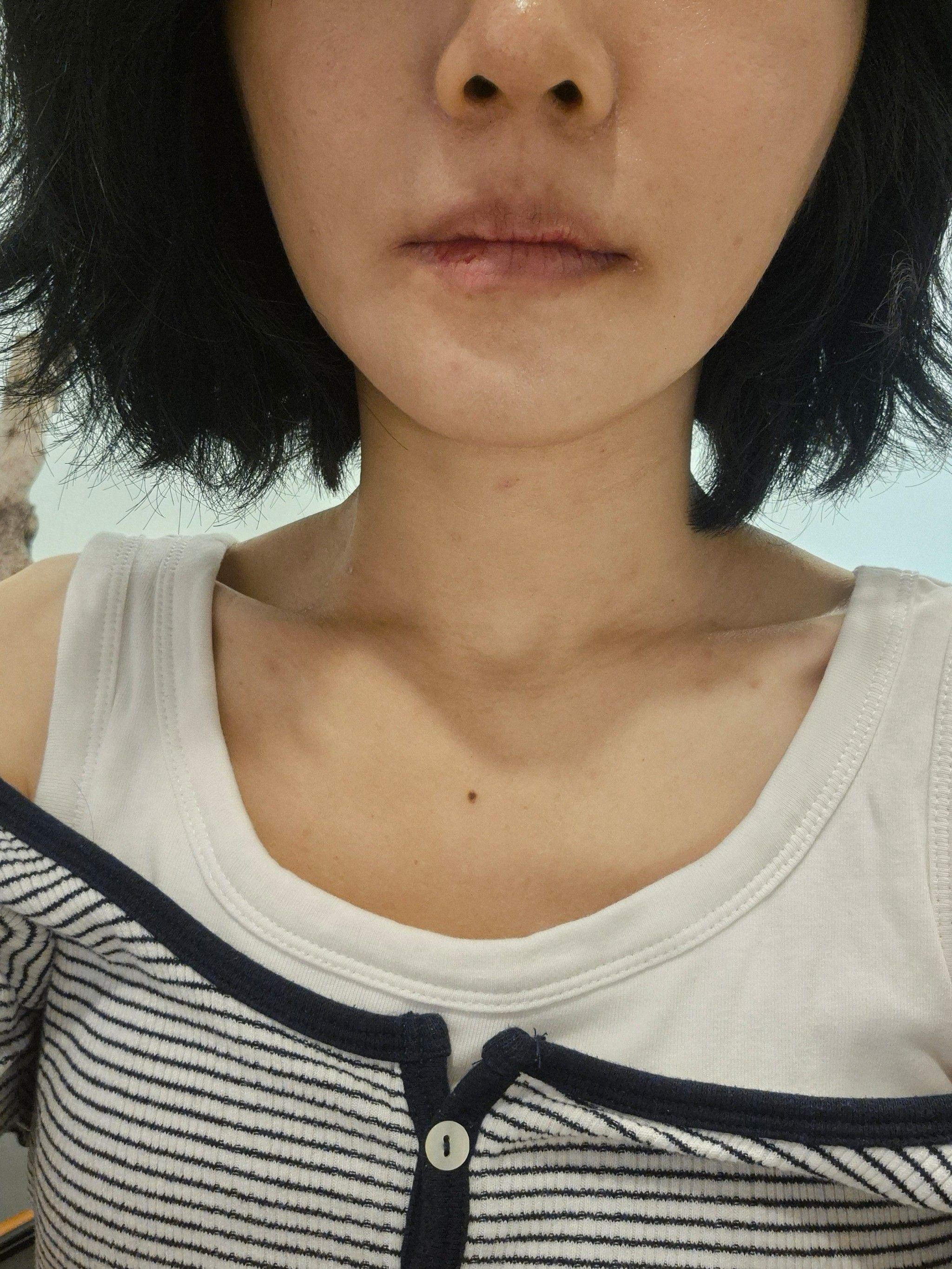 後