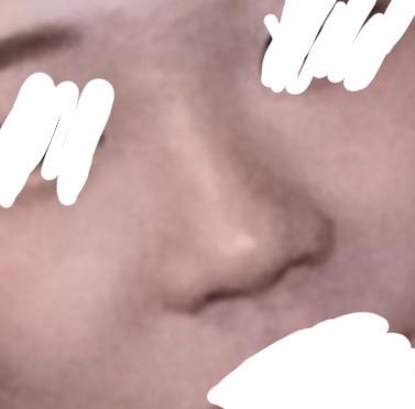 後