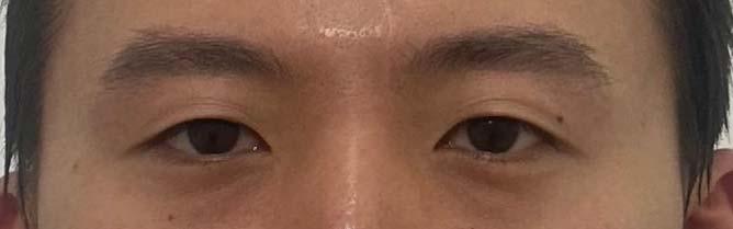 後