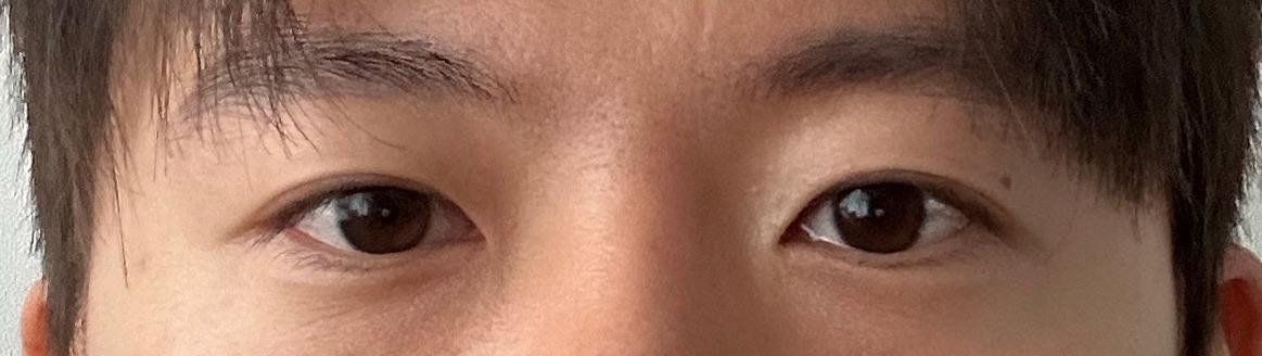 後