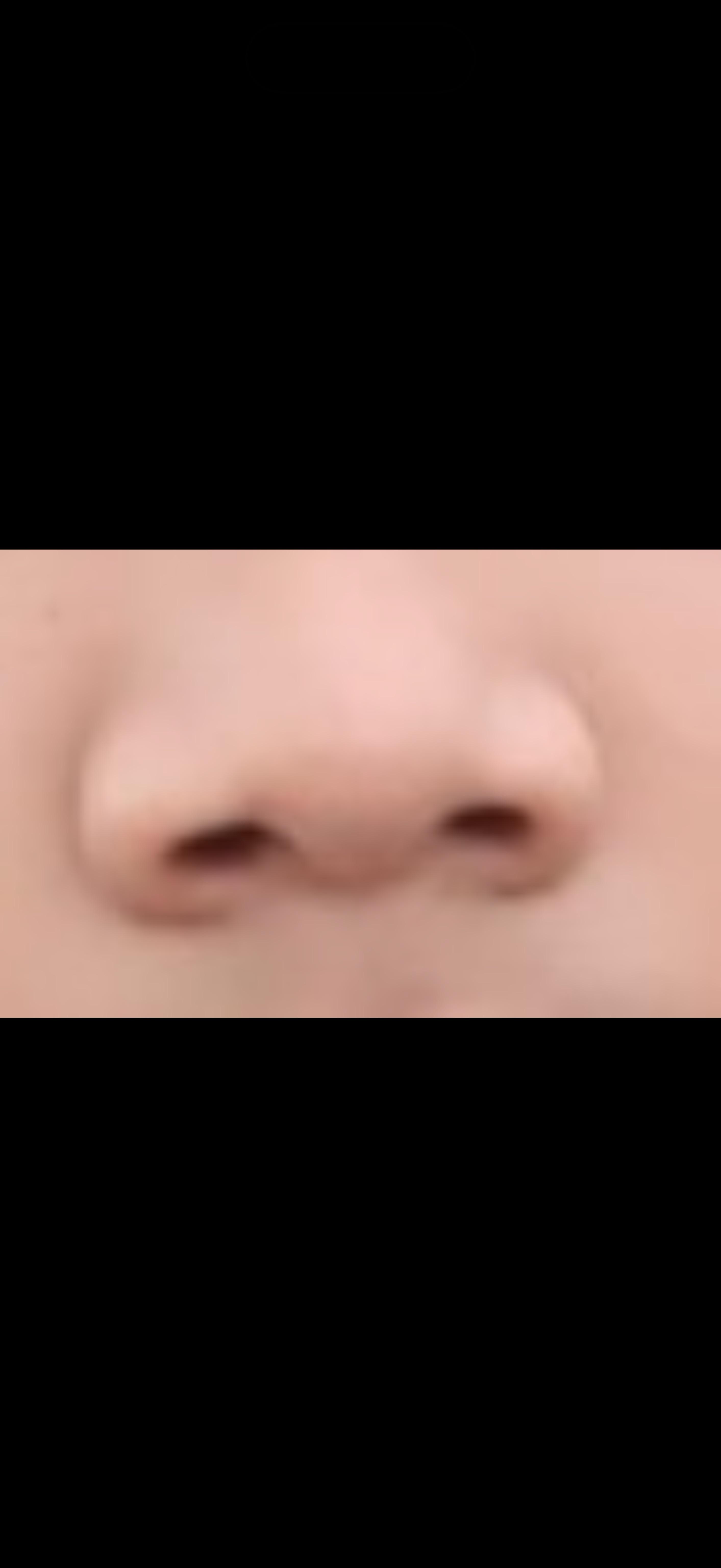 前