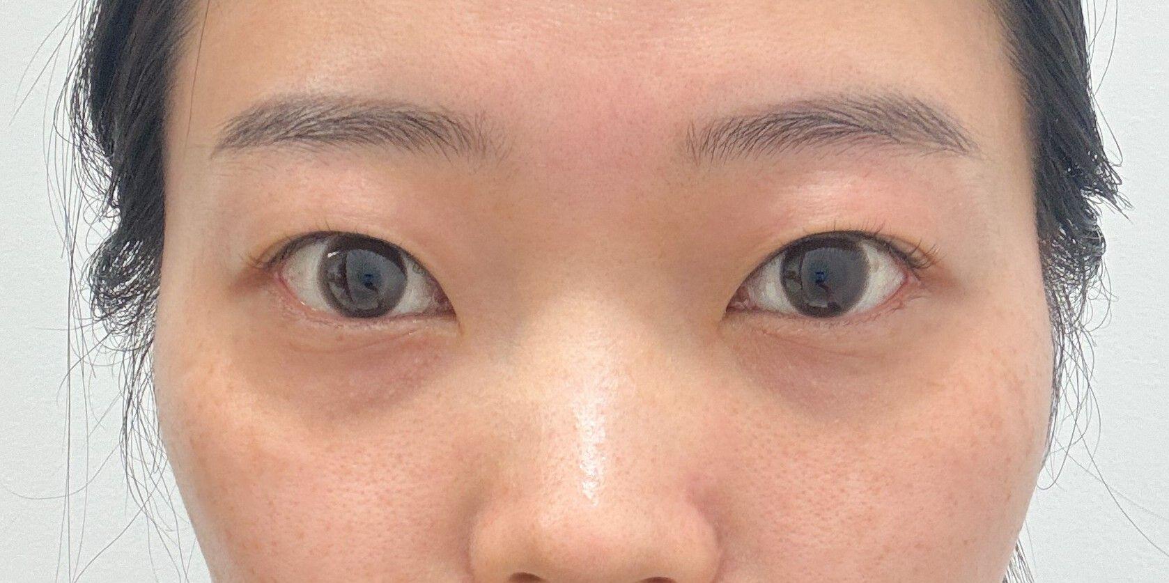 後