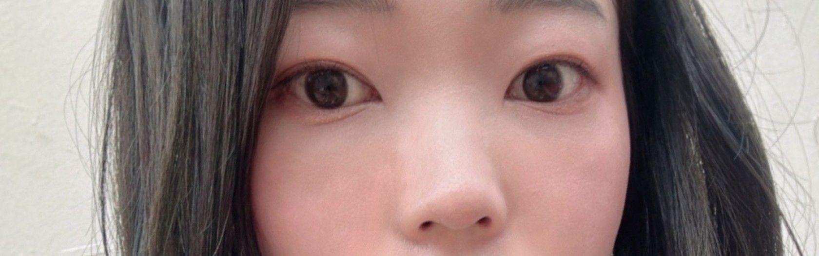 後