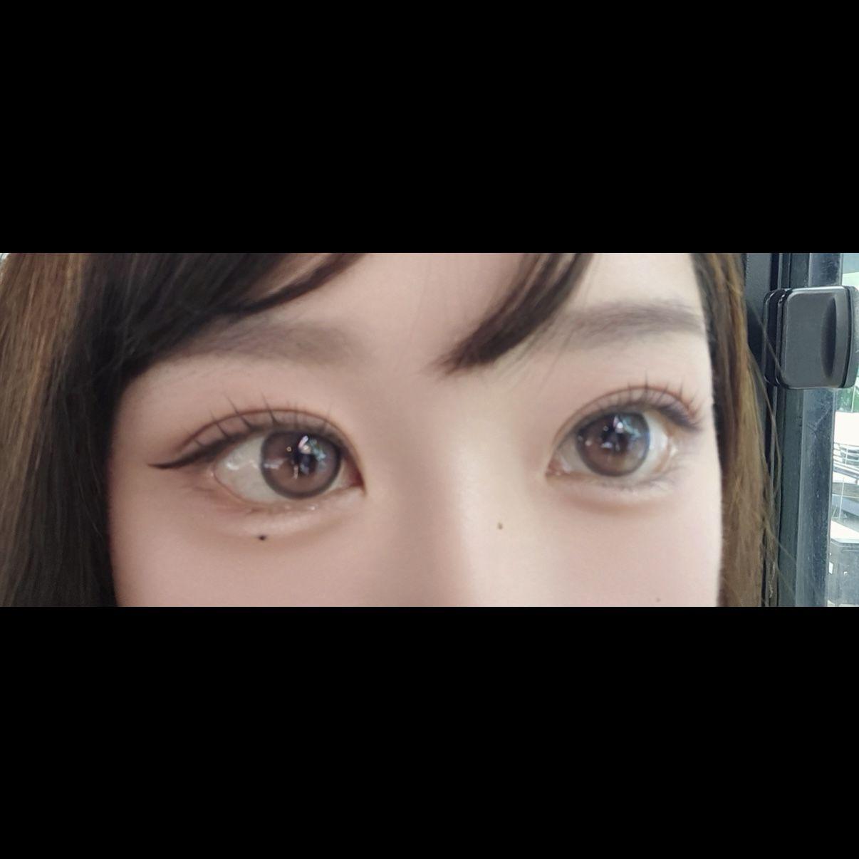 後