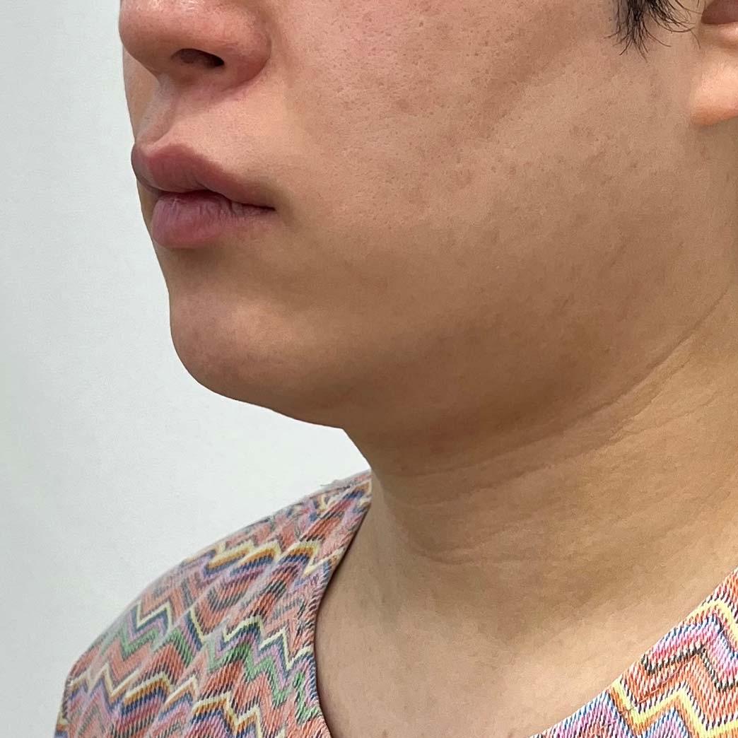 後