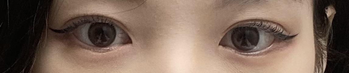 后