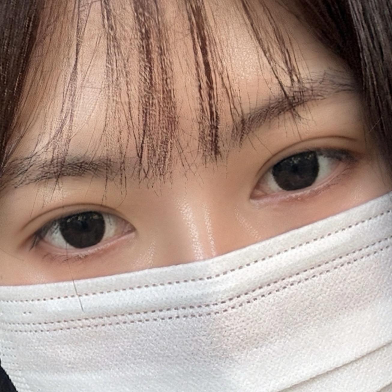 後