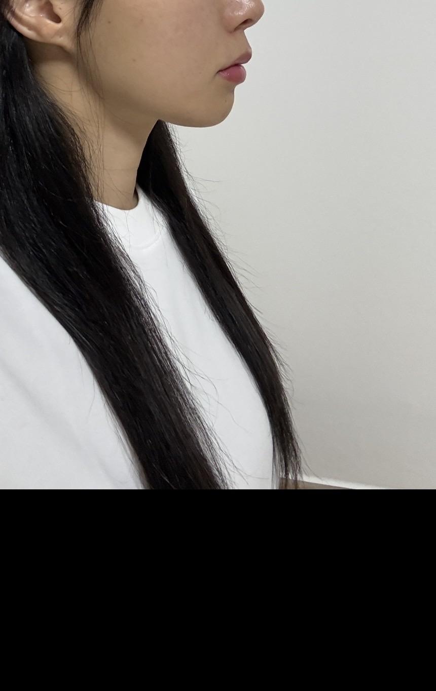 後