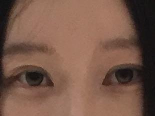 後