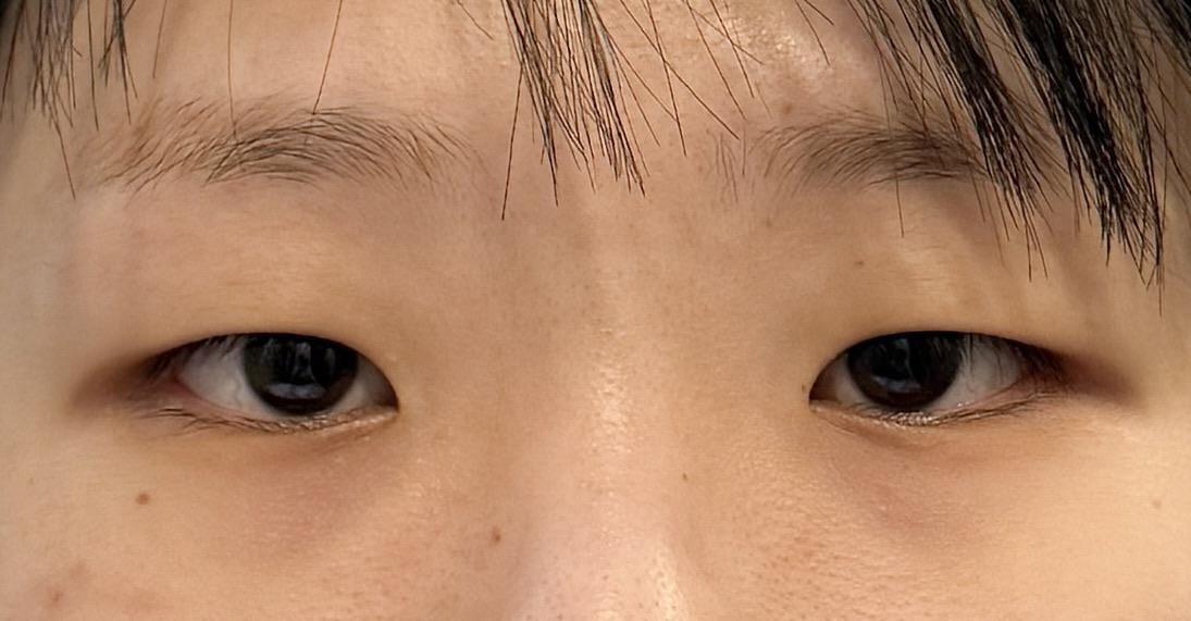 Before