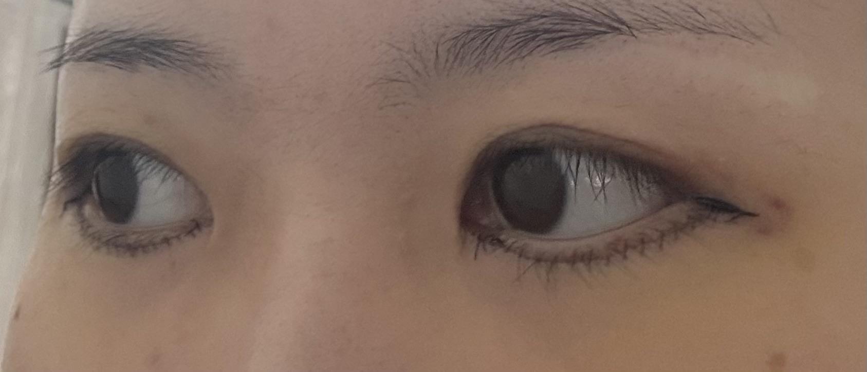 後