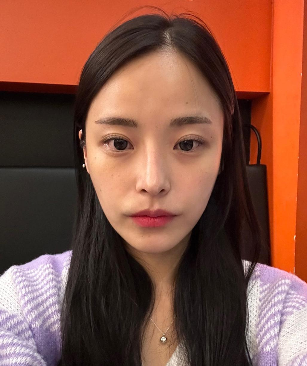 後