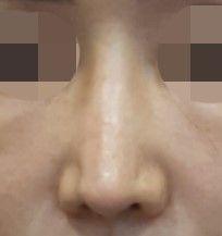 後
