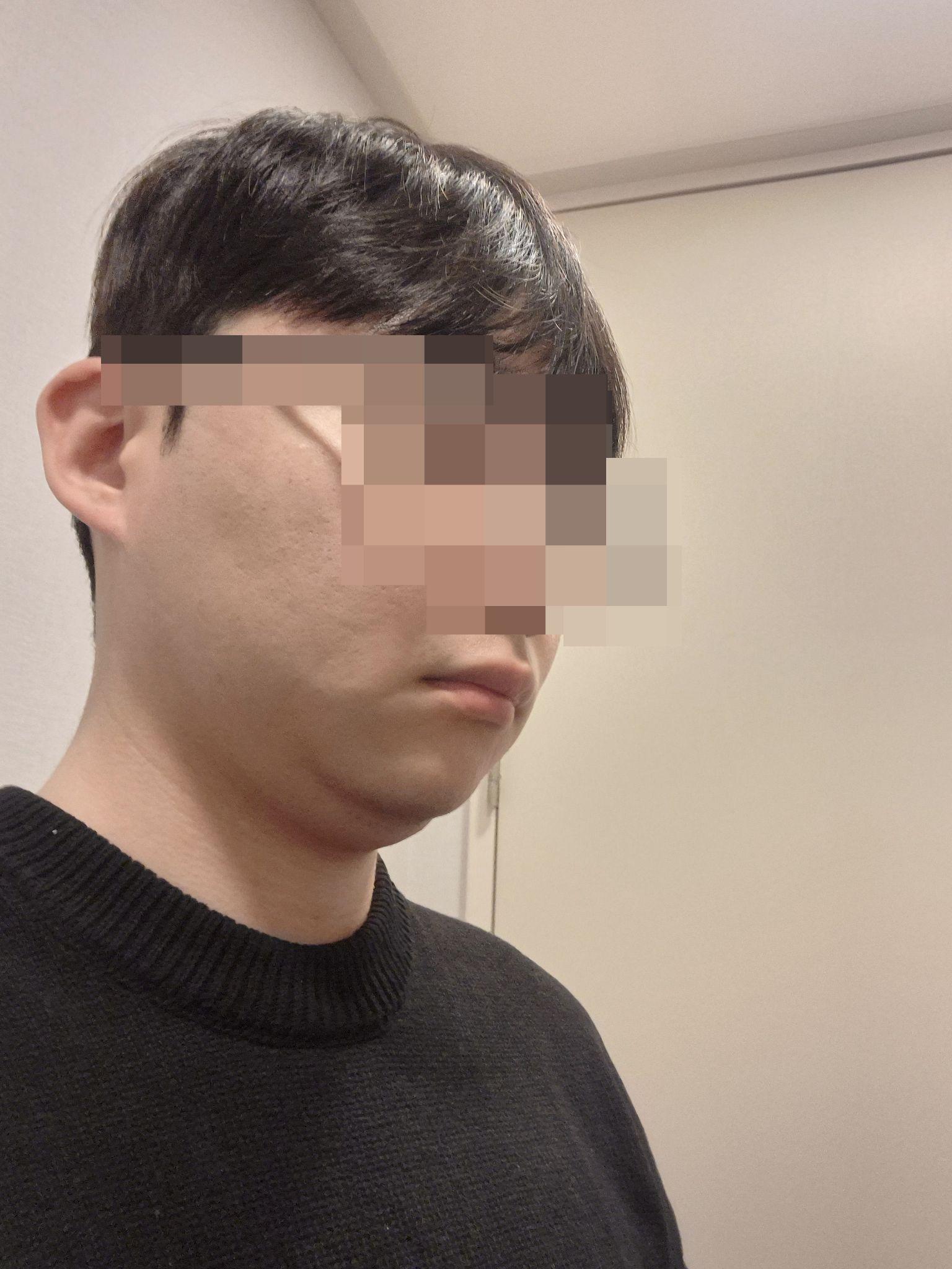 後
