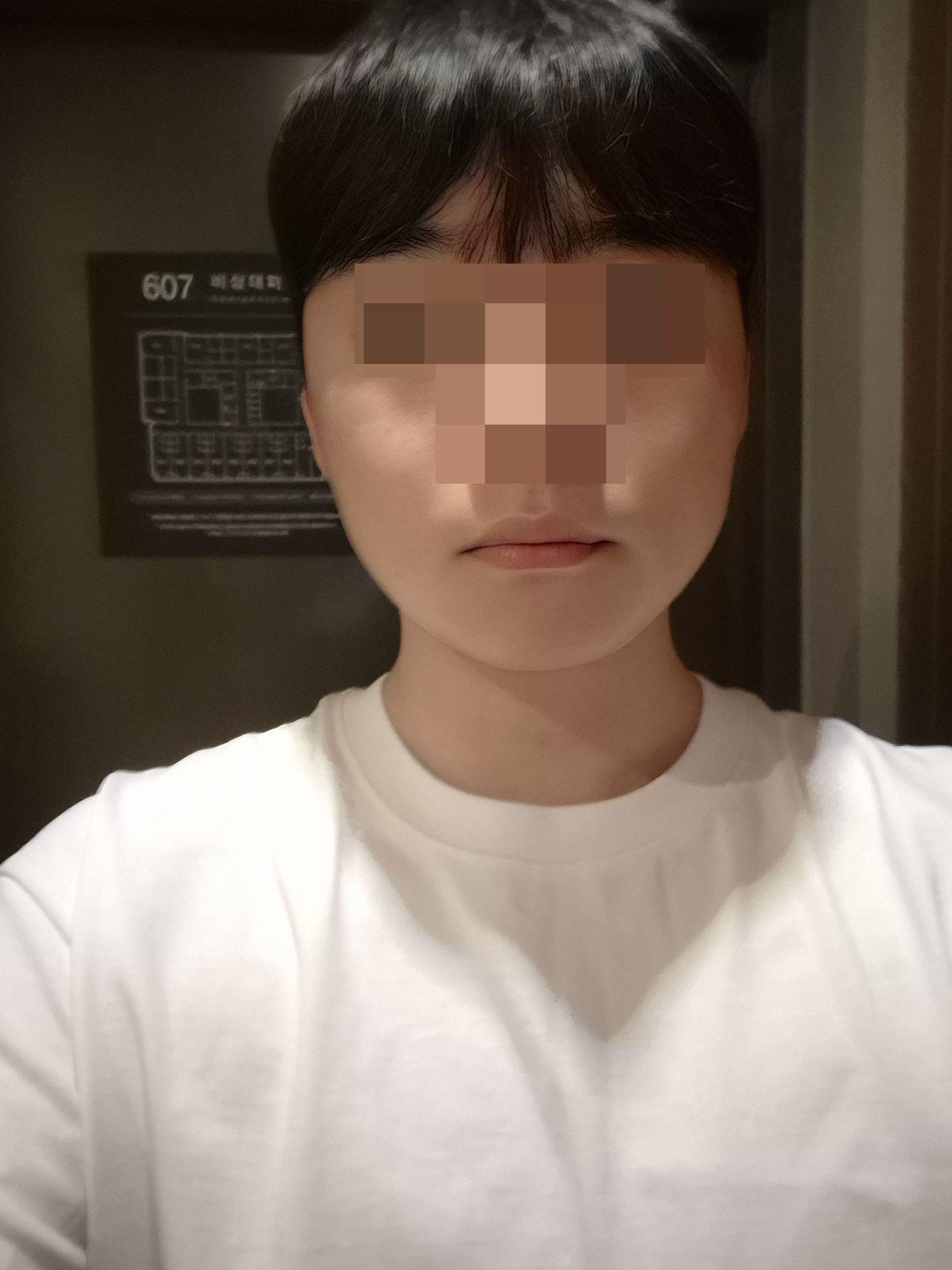後