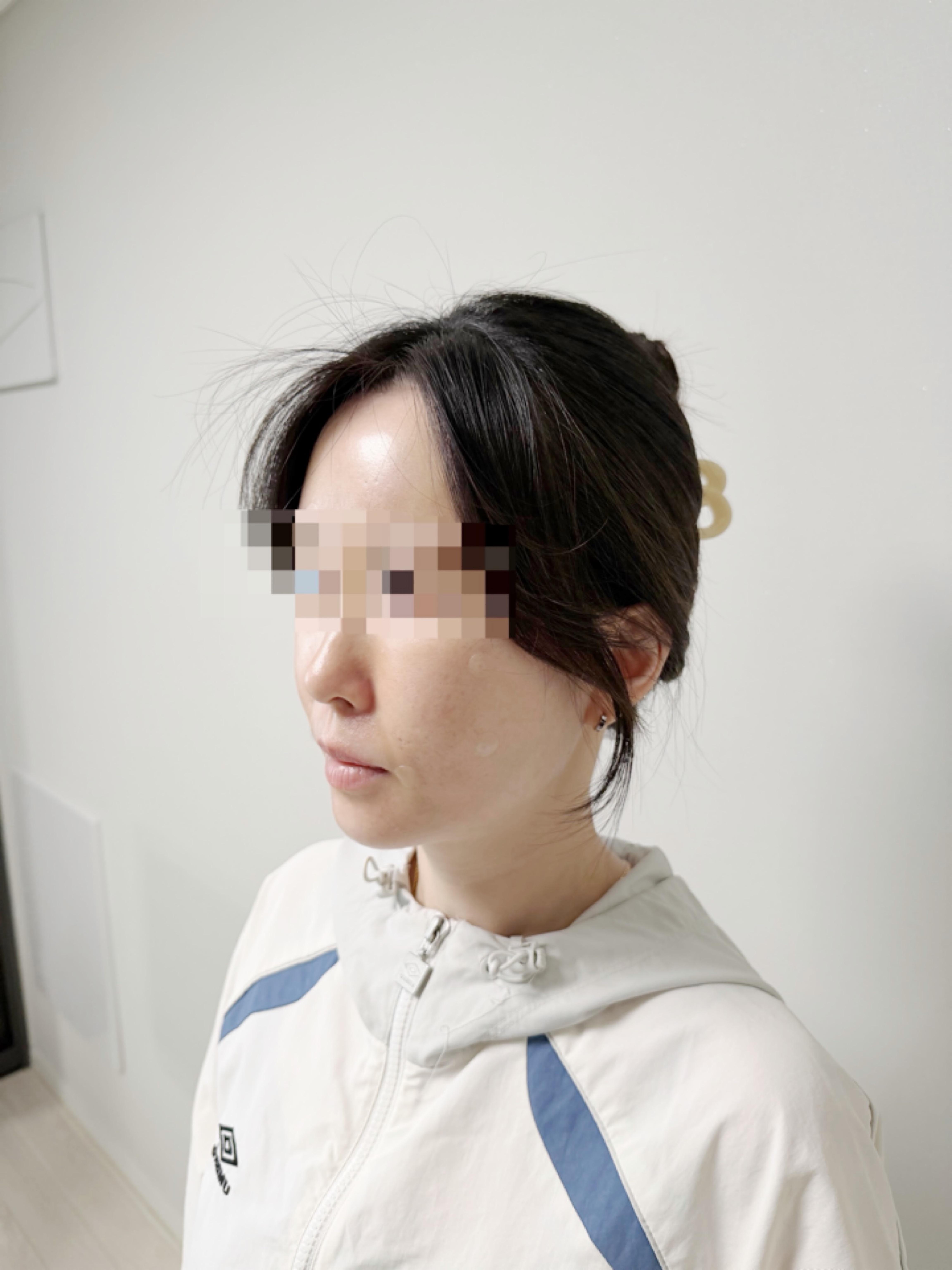 後