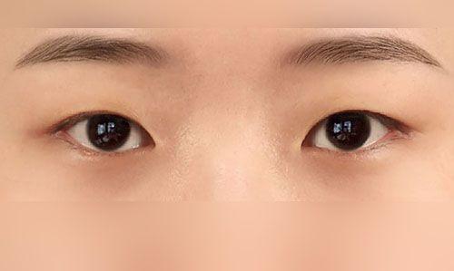 後