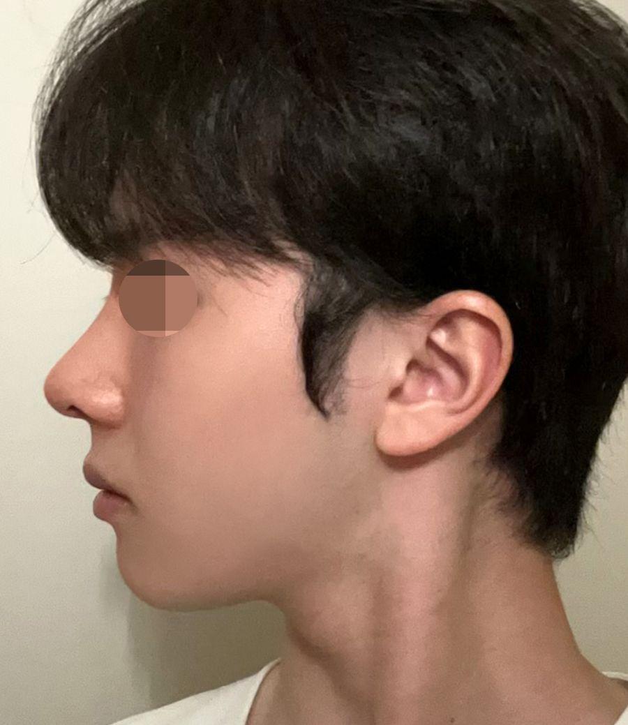 後