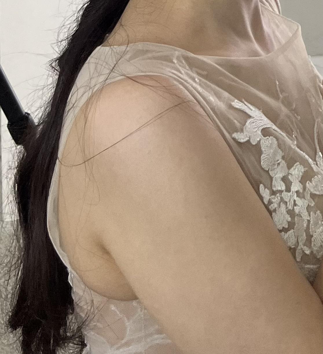 後