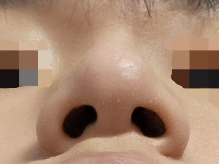 後
