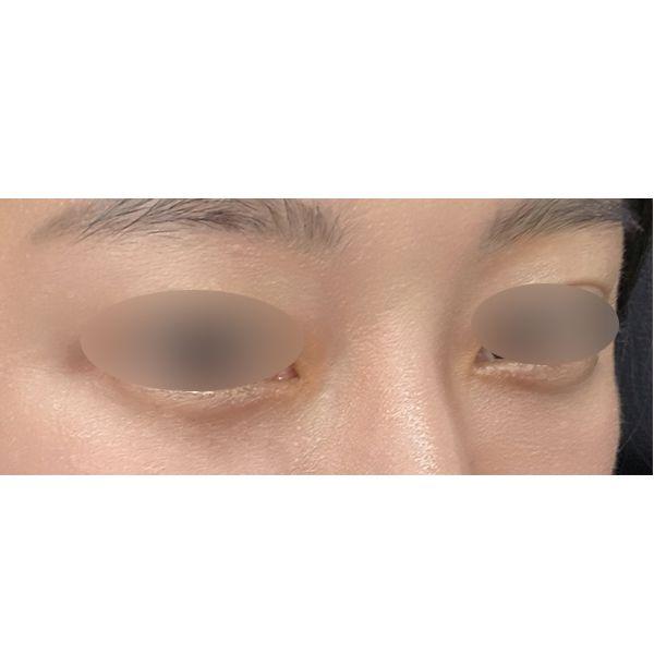 后