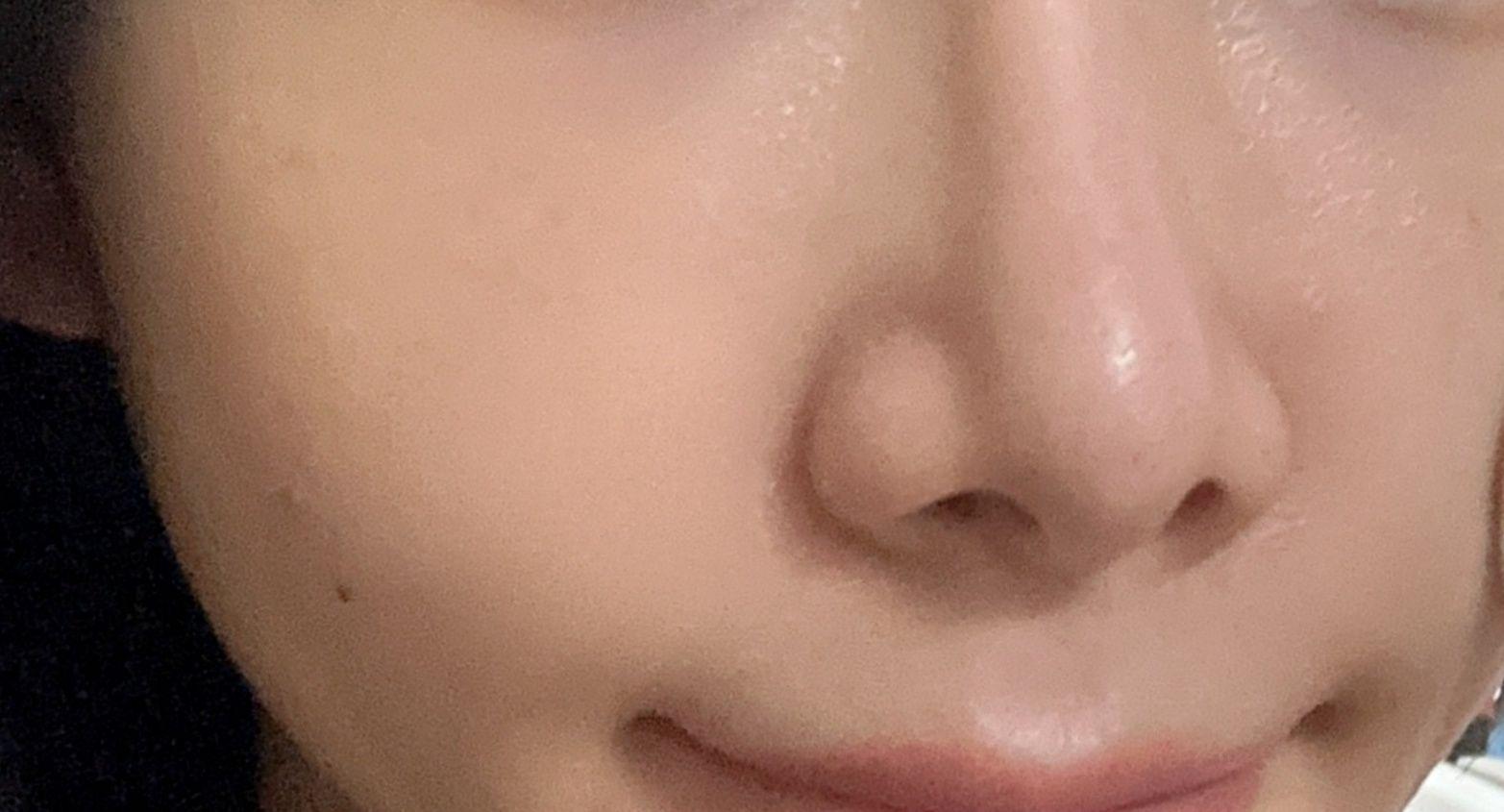 後