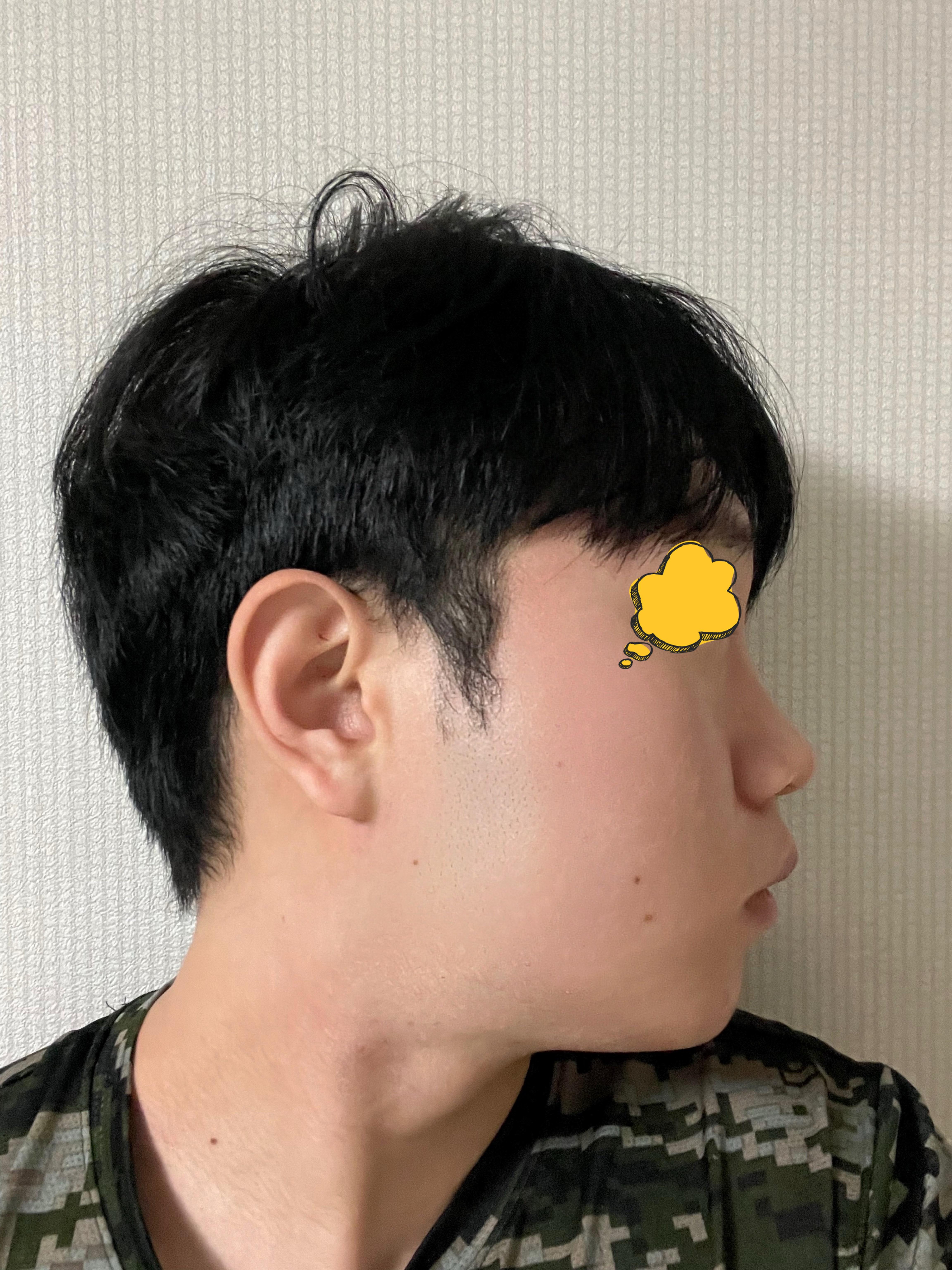 後