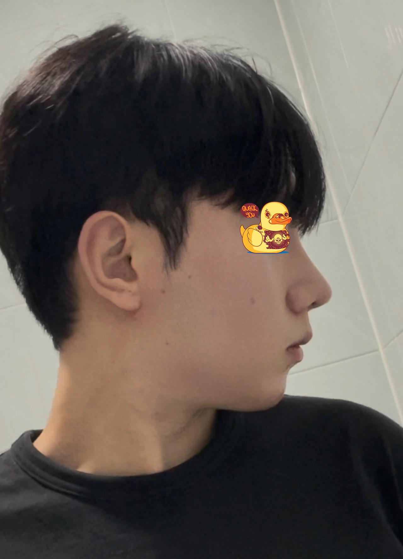 後