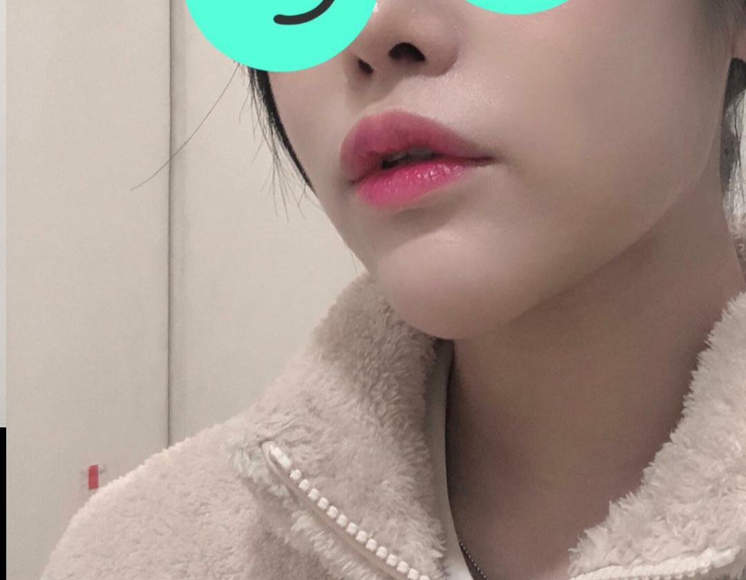 後