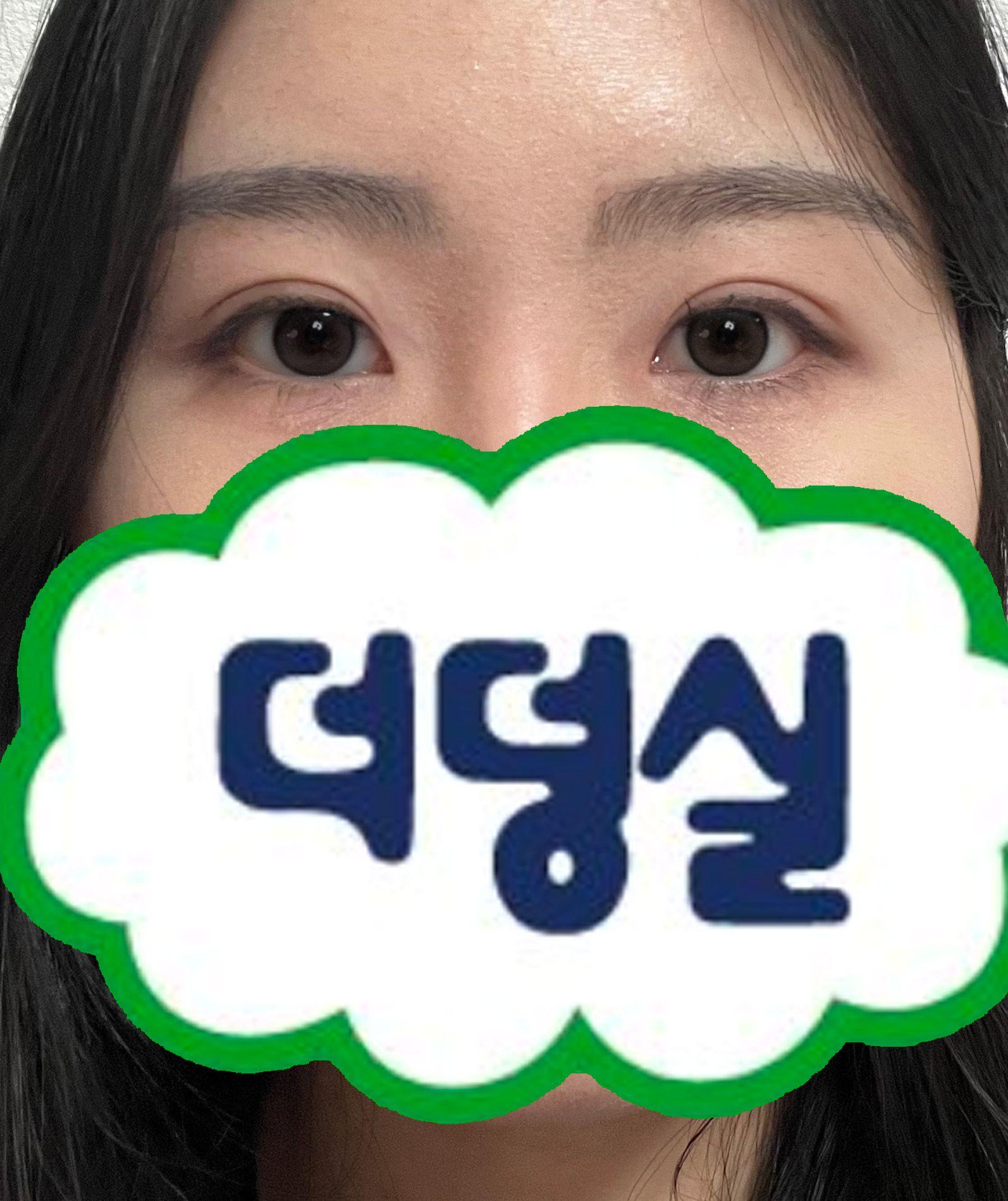 後