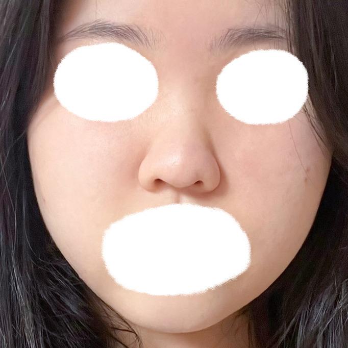 後