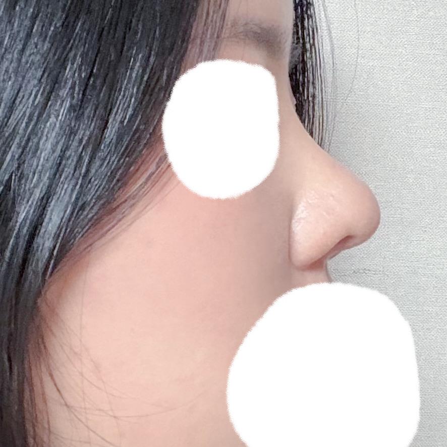 後