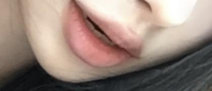 前