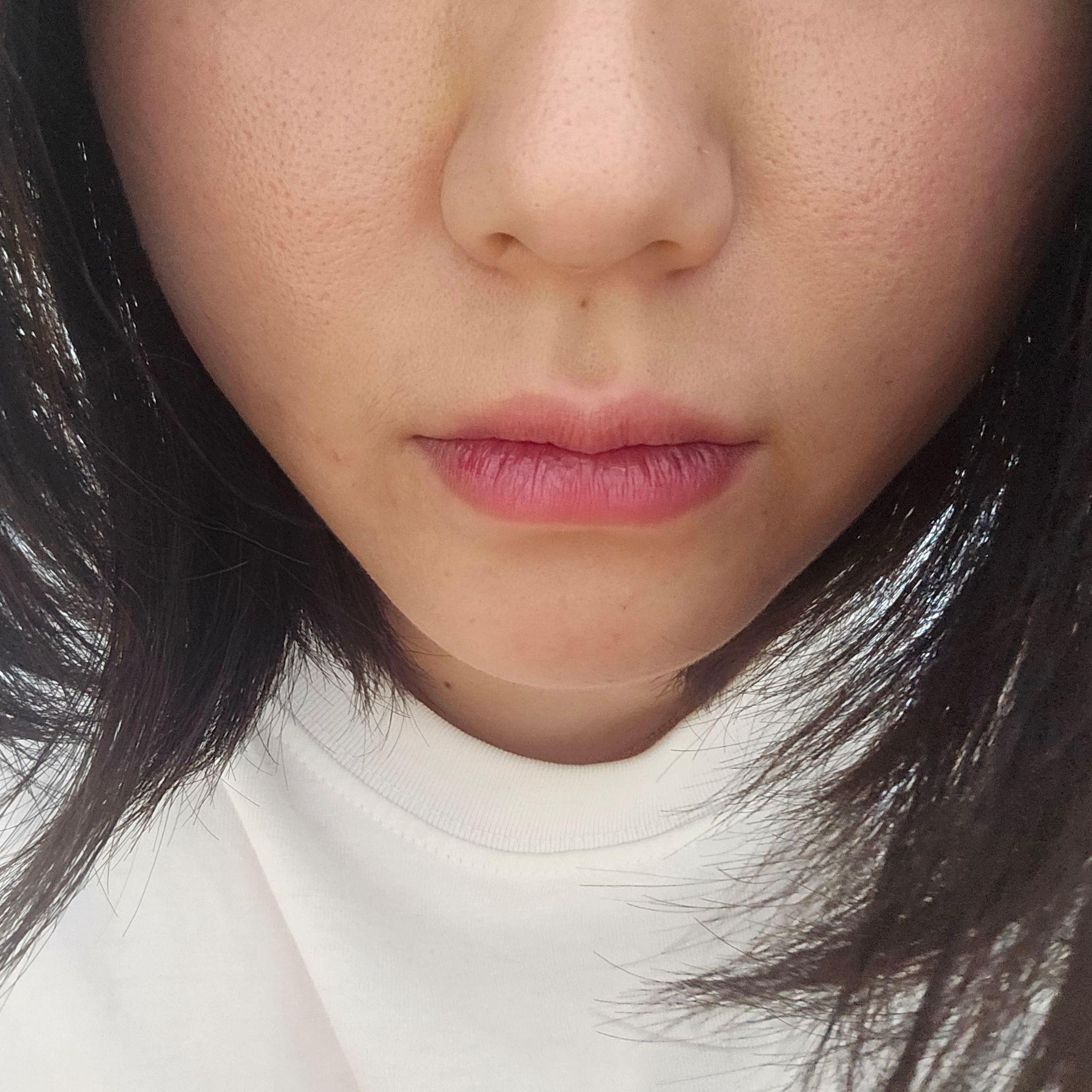 後