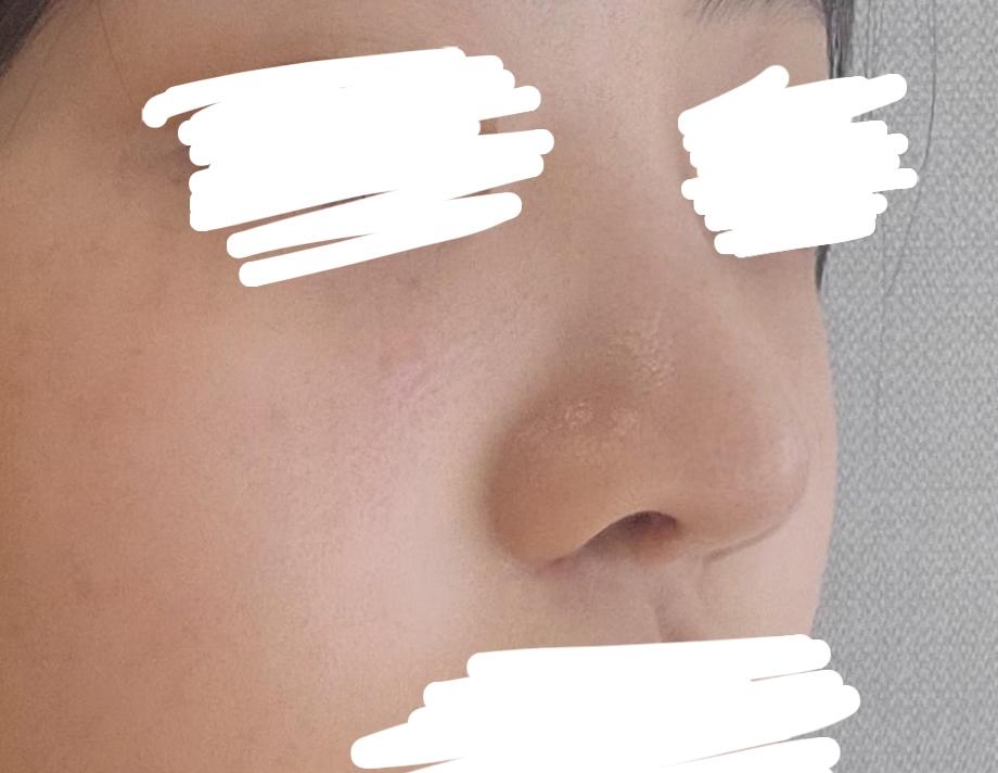 後