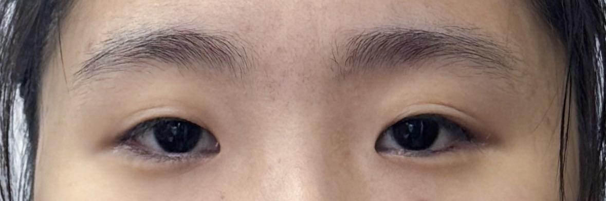 後