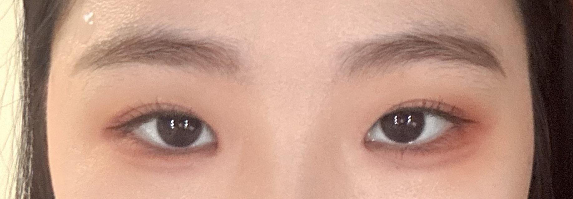 後