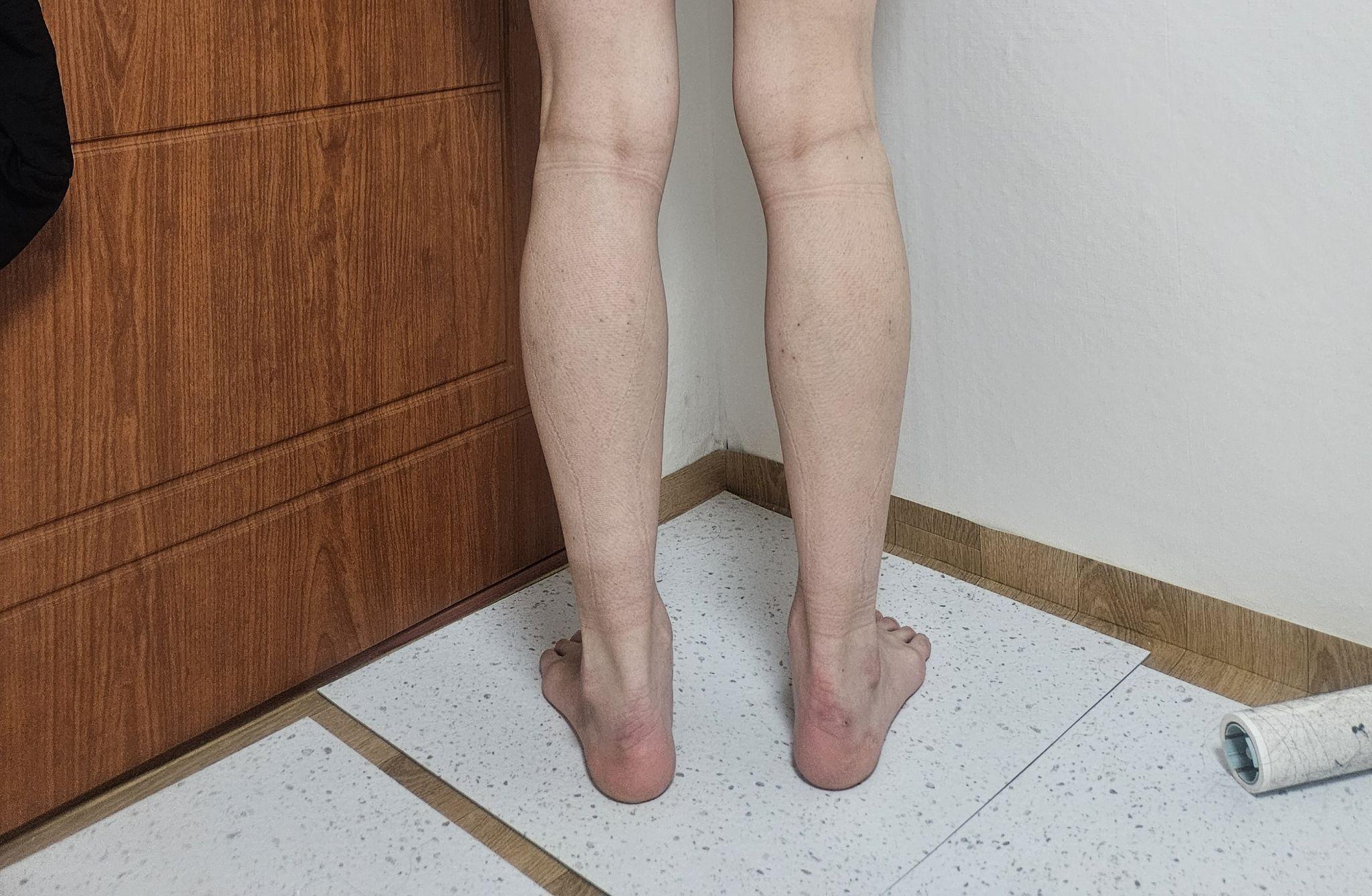 後