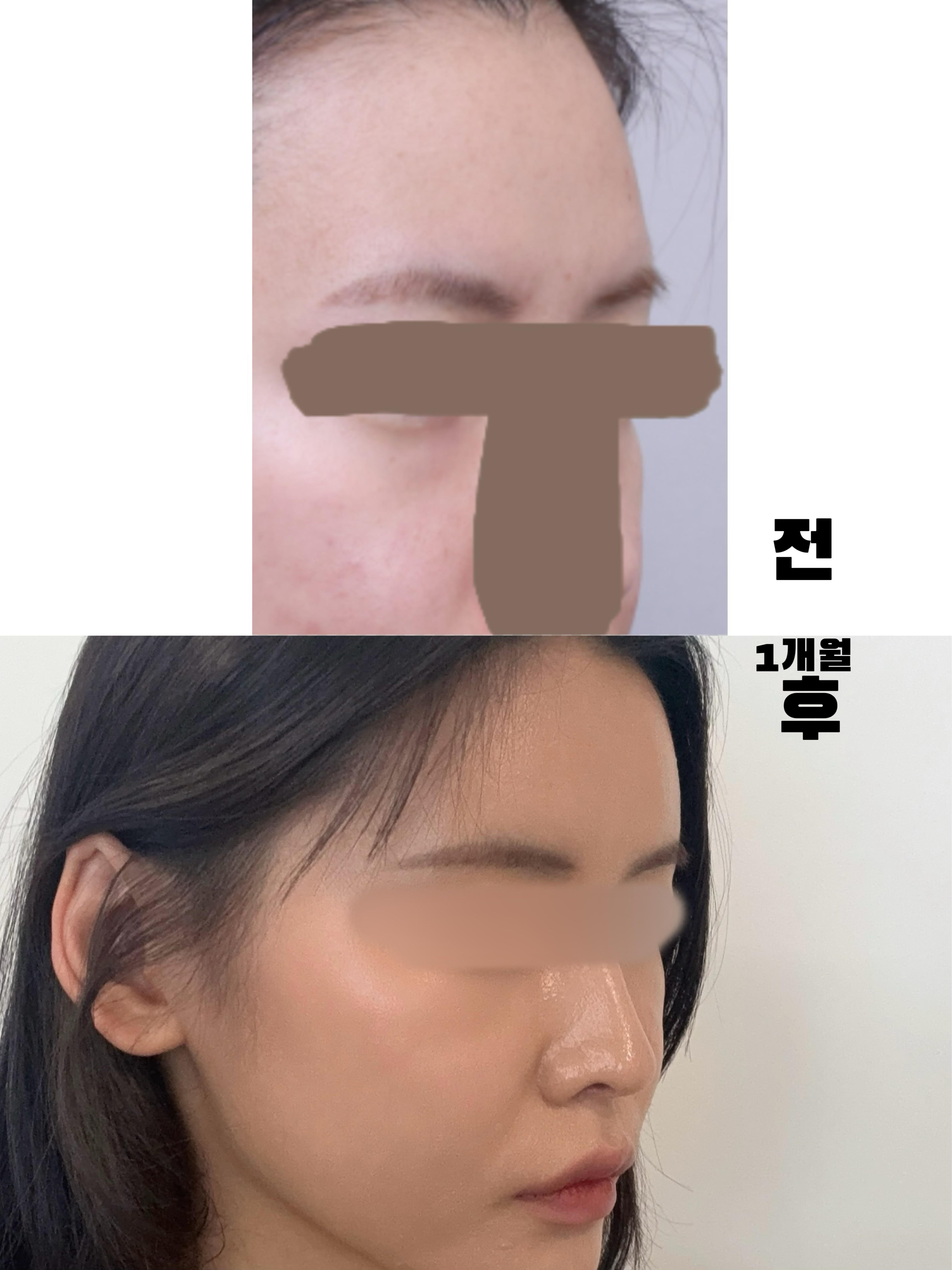 後