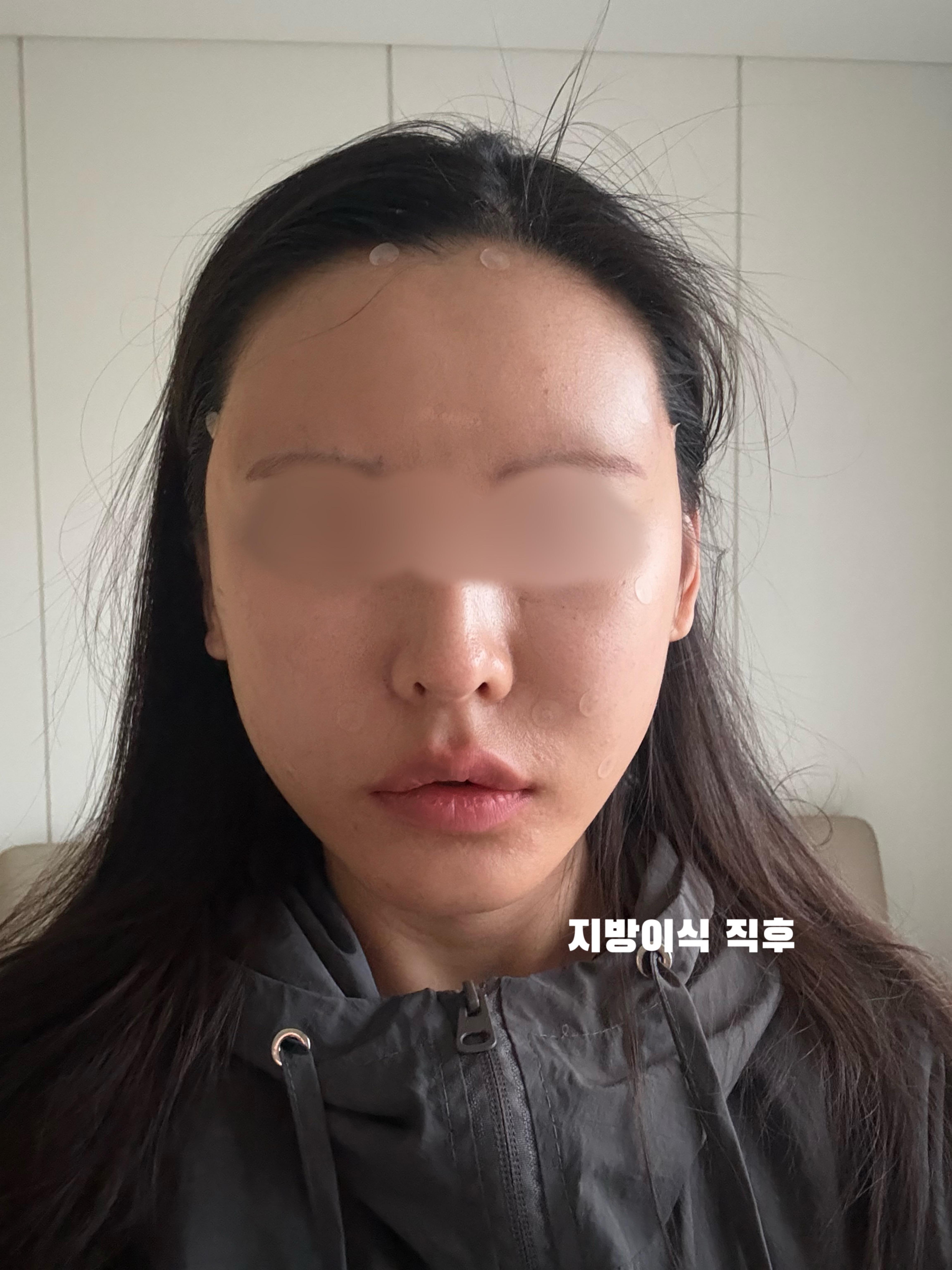 後